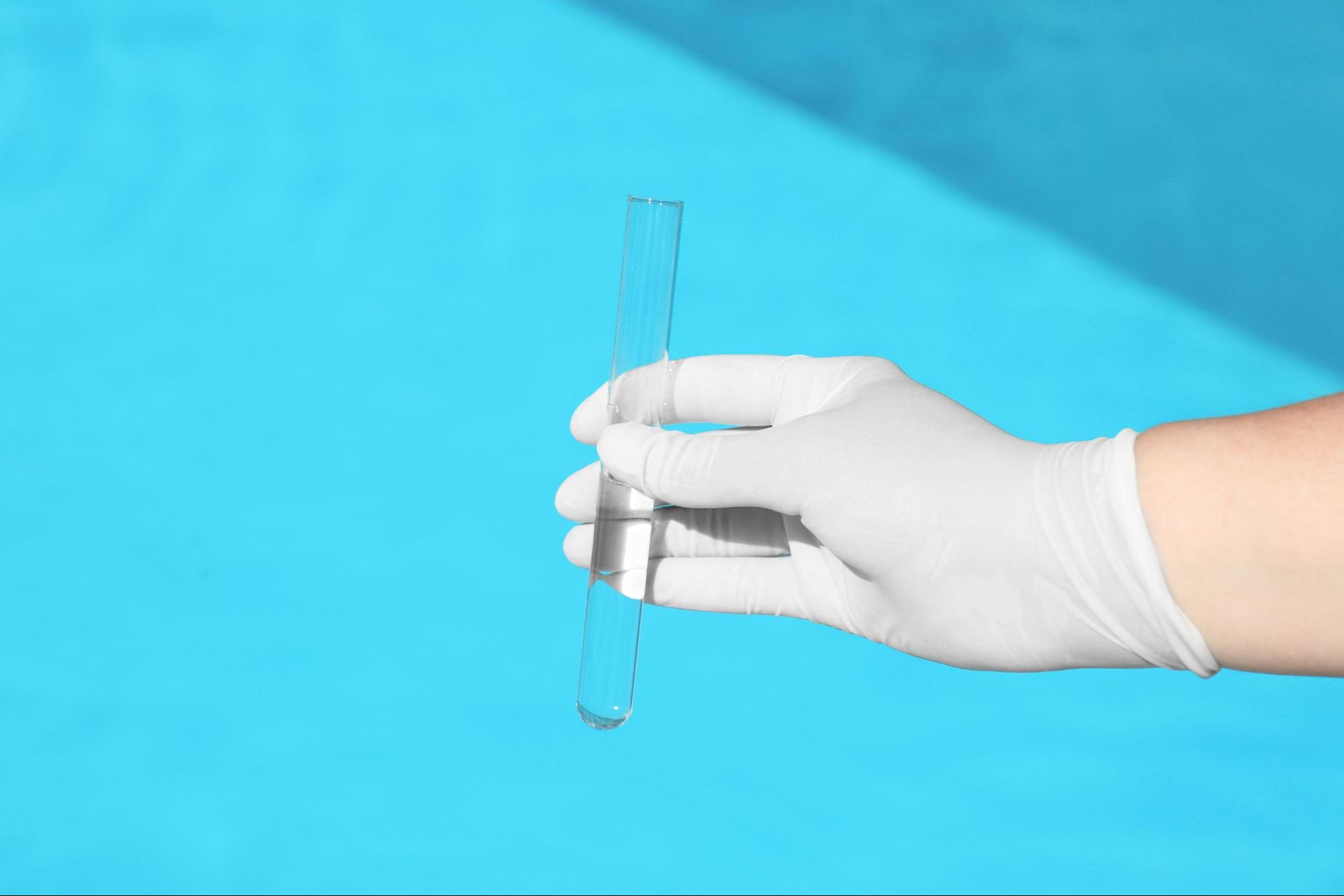 What Causes PH Changes In A Pool Select Pool Services